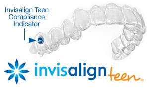Because Invisalign Teen Aligners Are 35