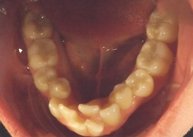 Pediatric Dentistry and Orthodontics of Virginia |